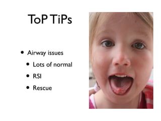 ToP TiPs
• Airway issues
• Lots of normal
• RSI
• Rescue
 