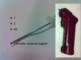 • 1
• 2
• IO
• Consider external jugular
 