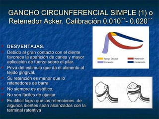 Retenedores Directos para Protesis Parcial Removible | PPT