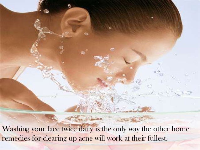 burn scar treatment home remedies