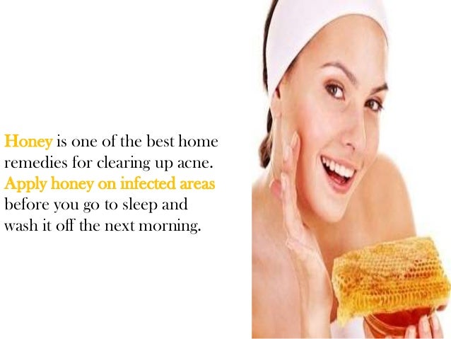 acne treatment acne treatments that work adult acn acne treatment acne treatments that work adult acn