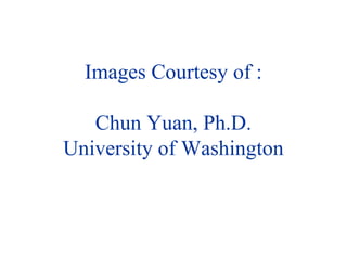 Images Courtesy of :
Chun Yuan, Ph.D.
University of Washington
 