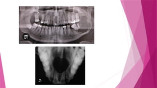 Radiology and radiograph in oral medicine pptx | PPTX