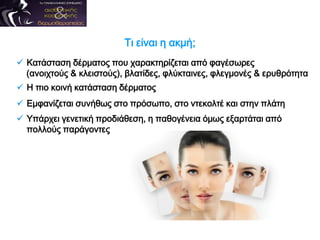  Κατάσταση δέρματος που χαρακτηρίζεται από φαγέσωρες
(ανοιχτούς & κλειστούς), βλατίδες, φλύκταινες, φλεγμονές & ερυθρότητα
 Η πιο κοινή κατάσταση δέρματος
 Εμφανίζεται συνήθως στο πρόσωπο, στο ντεκολτέ και στην πλάτη
 Υπάρχει γενετική προδιάθεση, η παθογένεια όμως εξαρτάται από
πολλούς παράγοντες
Τι είναι η ακμή;
 