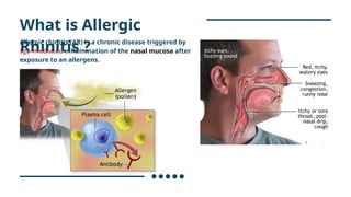 Allergic Rhinitis.pptx
