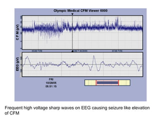 Frequent high voltage sharp waves on EEG causing seizure like elevation
of CFM
 