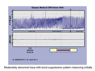 Moderately abnormal trace with burst suppression pattern improving initially
 