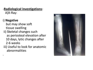 -Radiological investigations:
A)X-Ray:
i) Negative
but may show soft
tissue swelling
ii) Skeletal changes such
as periosteal elevation after
10 days, lytic changes after
2-6 weeks
iii) Useful to look for anatomic
abnormalities
.
 