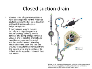 Closed suction drain
• Success rates of approximately 85%
have been reported for the modified
Lautenbach method of closed suction
antibiotic ingress and egress
irrigation systems
• A more recent wound closure
technique is negative pressure
wound therapy (NPWT), which
consists of a pump that generates a
vacuum and is capable of creating a
negative pressure environment
within a sealed wound, dressing
material used to pack and seal the
wound, tubing for fluid removal from
the wound area, and a container to
collect waste materials removed from
the wound
 