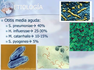 ETIOLOGÍA
 Otitis media aguda:
 S. pneumoniae 40%
 H. influenzae 25-30%
 M. catarrhalis 10-15%
 S. pyogenes 5%
 