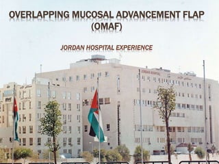 OVERLAPPING MUCOSAL ADVANCEMENT FLAP
(OMAF)
JORDAN HOSPITAL EXPERIENCE
 
