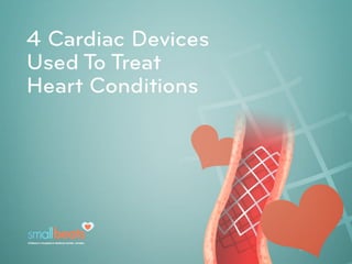 4 Cardiac Devices Used To Treat Heart Conditions