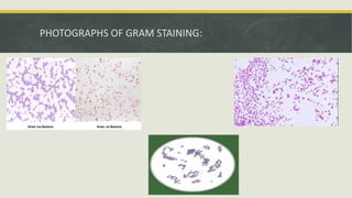 PHOTOGRAPHS OF GRAM STAINING:
 