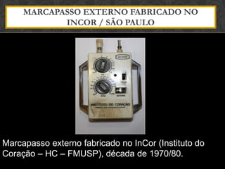 MARCAPASSO EXTERNO FABRICADO NO
INCOR / SÃO PAULO
Marcapasso externo fabricado no InCor (Instituto do
Coração – HC – FMUSP), década de 1970/80.
 