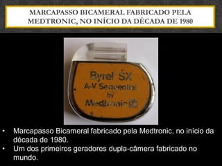 MARCAPASSO BICAMERAL FABRICADO PELA
MEDTRONIC, NO INÍCIO DA DÉCADA DE 1980
• Marcapasso Bicameral fabricado pela Medtronic, no início da
década de 1980.
• Um dos primeiros geradores dupla-câmera fabricado no
mundo.
 