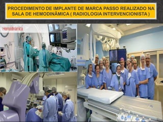 PROCEDIMENTO DE IMPLANTE DE MARCA PASSO REALIZADO NA
SALA DE HEMODINÂMICA ( RADIOLOGIA INTERVENCIONISTA )
 