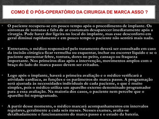 • O paciente recupera-se em pouco tempo após o procedimento de implante. Os
sintomas de tonturas e falta de ar costumam desaparecer imediatamente após a
cirurgia. Pode haver dor ligeira no local do implante, mas esse desconforto em
geral diminui rapidamente e em pouco tempo o paciente não sentirá mais nada.
• Entretanto, o médico responsável pelo tratamento deverá ser consultado em caso
da incisão cirúrgica ficar vermelha ou esquentar, inchar ou escorrer líquido e se o
paciente apresentar febre, tontura, dores no peito, cansaço ou fraqueza
importante. Nos primeiros dias após a intervenção, movimentos amplos com o
braço do lado do marca passo devem ser evitados.
• Logo após o implante, haverá a primeira avaliação e o médico verificará a
atividade cardíaca, as funções e os parâmetros do marca passo. A programação
será ajustada às necessidades individuais de cada paciente, o que é muito
simples, pois o médico utiliza um aparelho externo denominado programador
para a essa avaliação. Na maioria dos casos, o paciente nem percebe que o
aparelho foi reprogramado.
• A partir desse momento, o médico marcará acompanhamentos em intervalos
regulares, geralmente a cada seis meses. Nesses exames, avalia-se
detalhadamente o funcionamento do marca passo e o estado da bateria.
COMO É O PÓS-OPERATÓRIO DA CIRURGIA DE MARCA ASSO ?
 