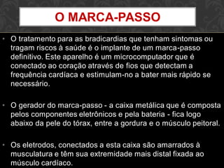 • O tratamento para as bradicardias que tenham sintomas ou
tragam riscos à saúde é o implante de um marca-passo
definitivo. Este aparelho é um microcomputador que é
conectado ao coração através de fios que detectam a
frequência cardíaca e estimulam-no a bater mais rápido se
necessário.
• O gerador do marca-passo - a caixa metálica que é composta
pelos componentes eletrônicos e pela bateria - fica logo
abaixo da pele do tórax, entre a gordura e o músculo peitoral.
• Os eletrodos, conectados a esta caixa são amarrados à
musculatura e têm sua extremidade mais distal fixada ao
músculo cardíaco.
O MARCA-PASSO
 