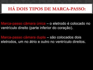 Marca-passo câmara única – o eletrodo é colocado no
ventrículo direito (parte inferior do coração).
Marca-passo câmara dupla – são colocados dois
eletrodos, um no átrio e outro no ventrículo direitos.
HÁ DOIS TIPOS DE MARCA-PASSO:
 