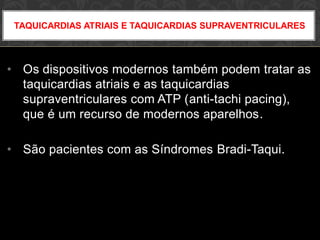 • Os dispositivos modernos também podem tratar as
taquicardias atriais e as taquicardias
supraventriculares com ATP (anti-tachi pacing),
que é um recurso de modernos aparelhos.
• São pacientes com as Síndromes Bradi-Taqui.
TAQUICARDIAS ATRIAIS E TAQUICARDIAS SUPRAVENTRICULARES
 