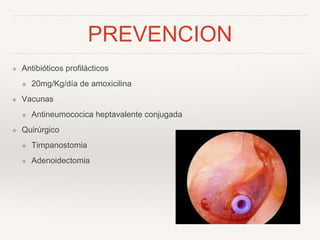 PREVENCION
❖ Antibióticos profilácticos
❖ 20mg/Kg/día de amoxicilina
❖ Vacunas
❖ Antineumococica heptavalente conjugada
❖ Quirúrgico
❖ Timpanostomia
❖ Adenoidectomia
 
