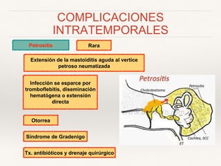 COMPLICACIONES
INTRATEMPORALES
Petrositis
Extensión de la mastoiditis aguda al vertice
petroso neumatizada
Rara
Infección se esparce por
tromboflebitis, diseminación
hematógena o extensión
directa
Otorrea
Síndrome de Gradenigo
Tx. antibióticos y drenaje quirúrgico
 
