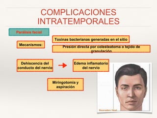 COMPLICACIONES
INTRATEMPORALES
Parálisis facial
Mecanismos:
Toxinas bacterianas generadas en el sitio
Presión directa por colesteatoma o tejido de
granulación
Dehiscencia del
conducto del nervio
Edema inflamatorio
del nervio
Miringotomia y
aspiración
 