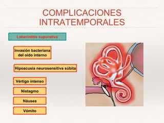 COMPLICACIONES
INTRATEMPORALES
Laberintitis supurativa
Hipoacusia neurosensitiva súbita
Vértigo intenso
Invasión bacteriana
del oído interno
Nistagmo
Náusea
Vómito
 