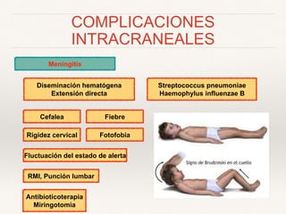 COMPLICACIONES
INTRACRANEALES
Meningitis
Streptococcus pneumoniae
Haemophylus influenzae B
Cefalea
Diseminación hematógena
Extensión directa
Fiebre
Rigidez cervical Fotofobia
Fluctuación del estado de alerta
RMI, Punción lumbar
Antibioticoterapia
Miringotomia
 