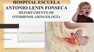 HOSPITAL ESCUELA
ANTONIO LENIN FONSECA
DEPARTAMENTO DE
OTORRINOLARINGOLOGÍA
Otitis media y sus complicaciones
MANAGUA
 