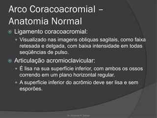 Arco Coracoacromial –
Anatomia Normal
 Ligamento coracoacromial:
 Visualizado nas imagens obliquas sagitais, como faixa
retesada e delgada, com baixa intensidade em todas
seqüências de pulso.
 Articulação acromioclavicular:
 É lisa na sua superfície inferior, com ambos os ossos
correndo em um plano horizontal regular.
 A superfície inferior do acrômio deve ser lisa e sem
esporões.
Dr. Emanuel R. Dantas
 
