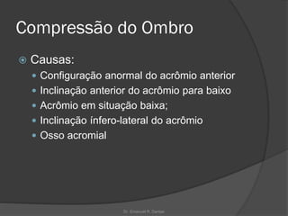 Compressão do Ombro
 Causas:
 Configuração anormal do acrômio anterior
 Inclinação anterior do acrômio para baixo
 Acrômio em situação baixa;
 Inclinação ínfero-lateral do acrômio
 Osso acromial
Dr. Emanuel R. Dantas
 