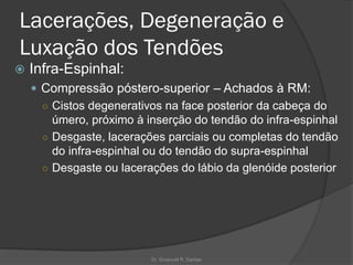 Lacerações, Degeneração e
Luxação dos Tendões
 Infra-Espinhal:
 Compressão póstero-superior – Achados à RM:
○ Cistos degenerativos na face posterior da cabeça do
úmero, próximo à inserção do tendão do infra-espinhal
○ Desgaste, lacerações parciais ou completas do tendão
do infra-espinhal ou do tendão do supra-espinhal
○ Desgaste ou lacerações do lábio da glenóide posterior
Dr. Emanuel R. Dantas
 