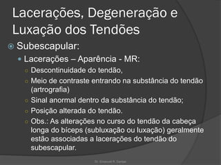 Lacerações, Degeneração e
Luxação dos Tendões
 Subescapular:
 Lacerações – Aparência - MR:
○ Descontinuidade do tendão,
○ Meio de contraste entrando na substância do tendão
(artrografia)
○ Sinal anormal dentro da substância do tendão;
○ Posição alterada do tendão.
○ Obs.: As alterações no curso do tendão da cabeça
longa do bíceps (subluxação ou luxação) geralmente
estão associadas a lacerações do tendão do
subescapular.
Dr. Emanuel R. Dantas
 