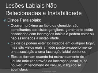 Lesões Labiais Não
Relacionadas a Instabilidade
 Cistos Paralabiais:
 Ocorrem próximo ao lábio da glenóide, são
semelhantes aos cistos ganglions, geralmente estão
associados com lacerações labiais e podem estar ou
não associados a instabilidade.
 Os cistos podem estar localizados em qualquer lugar,
mas são vistos mais amiúde póstero-superiormente
em associação a uma laceração labial posterior.
 Eles se formam quando há extravasamento de
líquido articular através da laceração labial, e, se
houver um fenômeno de válvulo, o líquido se
acumulará. Dr. Emanuel R. Dantas
 