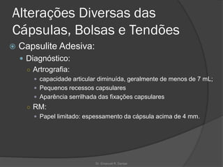 Alterações Diversas das
Cápsulas, Bolsas e Tendões
 Capsulite Adesiva:
 Diagnóstico:
○ Artrografia:
 capacidade articular diminuída, geralmente de menos de 7 mL;
 Pequenos recessos capsulares
 Aparência serrilhada das fixações capsulares
○ RM:
 Papel limitado: espessamento da cápsula acima de 4 mm.
Dr. Emanuel R. Dantas
 