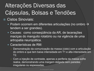 Alterações Diversas das
Cápsulas, Bolsas e Tendões
 Cistos Sinoviais:
 Podem ocorrem em diferentes articulações (no ombro →
tendem a ser grandes).
 Causas: como conseqüência da AR, de lacerações
maciças do manguito rotatório ou na vigência de uma
artropatia neuropática.
 Características de RM:
○ Demonstração da comunicação da massa (cisto) com a articulação
do ombro e que tem baixa intensidade em T1 e alta intensidade em
T2.
○ Com a injeção de contraste, apenas a periferia da massa sofre
realce, demonstrando uma margem delgada sem paredes
irregulares ou espessadas.
Dr. Emanuel R. Dantas
 