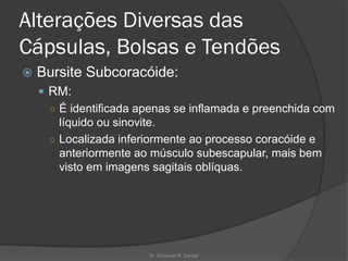 Alterações Diversas das
Cápsulas, Bolsas e Tendões
 Bursite Subcoracóide:
 RM:
○ É identificada apenas se inflamada e preenchida com
líquido ou sinovite.
○ Localizada inferiormente ao processo coracóide e
anteriormente ao músculo subescapular, mais bem
visto em imagens sagitais oblíquas.
Dr. Emanuel R. Dantas
 