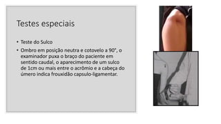 Testes especiais
• Teste do Sulco
• Ombro em posição neutra e cotovelo a 90°, o
examinador puxa o braço do paciente em
sentido caudal, o aparecimento de um sulco
de 1cm ou mais entre o acrômio e a cabeça do
úmero indica frouxidão capsulo-ligamentar.
 