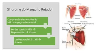 Síndrome do Manguito Rotador
Compressão dos tendões do
MR no espaço subacromial.
Lesões totais 5-39% 
Degenerativo  Idosos
Lesões parciais 3-13% 
Jovens
 