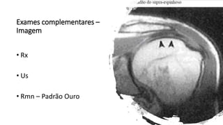 Exames complementares –
Imagem
• Rx
• Us
• Rmn – Padrão Ouro
 