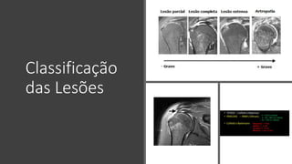 Classificação
das Lesões
 