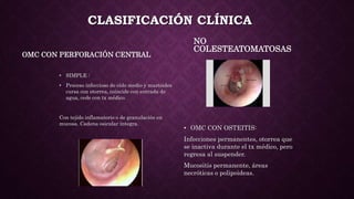 CLASIFICACIÓN CLÍNICA
OMC CON PERFORACIÓN CENTRAL
• SIMPLE :
• Proceso infeccioso de oído medio y mastoides
cursa con otorrea, coincide con entrada de
agua, cede con tx médico.
Con tejido inflamatorio o de granulación en
mucosa. Cadena osicular íntegra.
NO
COLESTEATOMATOSAS
• OMC CON OSTEITIS:
Infecciones permanentes, otorrea que
se inactiva durante el tx médico, pero
regresa al suspender.
Mucositis permanente, áreas
necróticas o polipoideas.
 