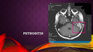 PETROSITIS
 