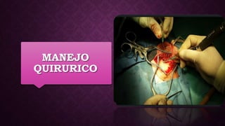 MANEJO
QUIRURICO
 