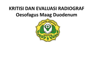 KRITISI DAN EVALUASI RADIOGRAF
Oesofagus Maag Duodenum
 