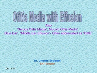 06/18/14 1
Also
“Serous Otitis Media”, Mucoid Otitis Media”,
Glue Ear”, “Middle Ear Effusion”- Often abbreviated as “OME”
Dr. Ghulam Sequlain
ENT Surgeon
 