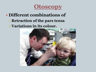 Otoscopy
 Different combinations of
 Retraction of the pars tensa
 Variations in its colour.
 