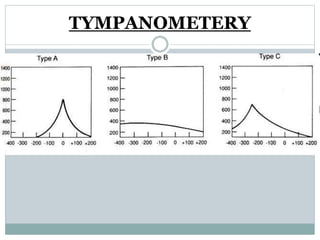 TYMPANOMETERY
 
