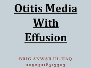 BRIG ANWAR UL HAQ
00923018513303
Otitis Media
With
Effusion
 